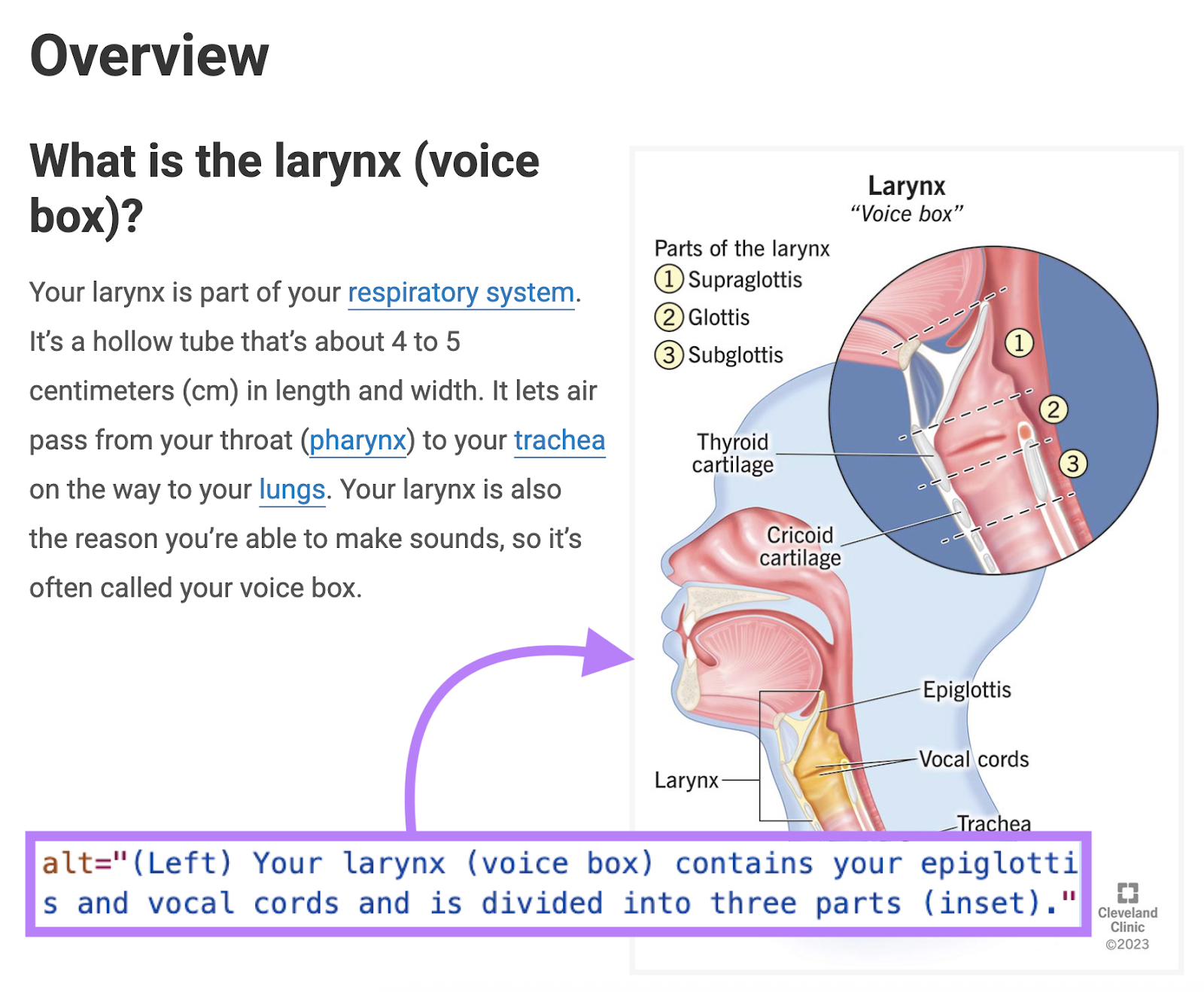 An image shows a diagram of a throat and the alt text says, "Your larynx (voice box) contains your epiglottis and vocal cords..."